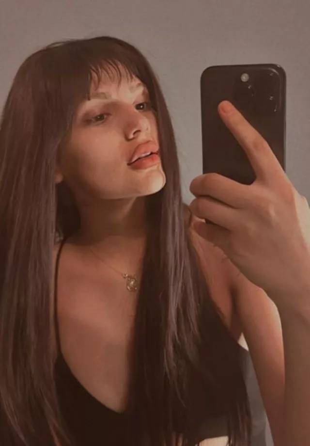 Kısmetse Olur'dan diskalifiye edilen Aybüke Çangal'ın estetiksiz hali ifşalandı! Kısmetse olur Aybüke estetik yaptırdı mı? 3